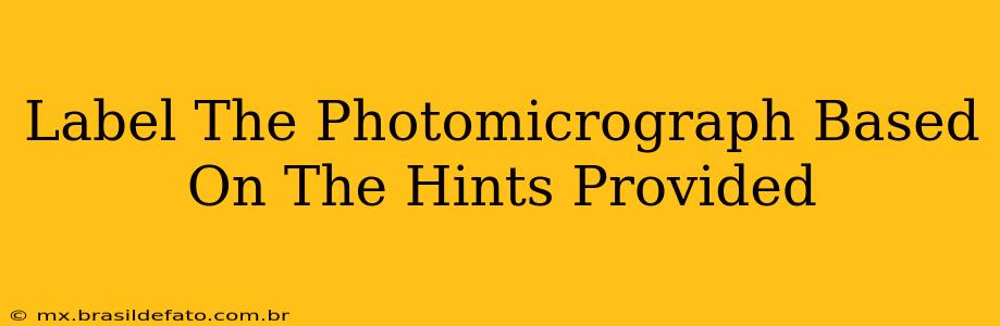 Label The Photomicrograph Based On The Hints Provided